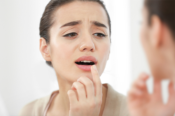 when to consult a doctor regarding chapped lips?