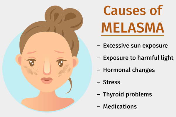 causes behind melasma