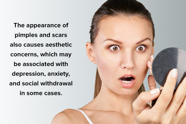 complications of untreated pimples