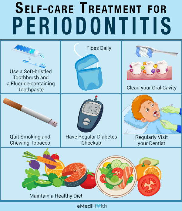 self-care tips to prevent periodontitis