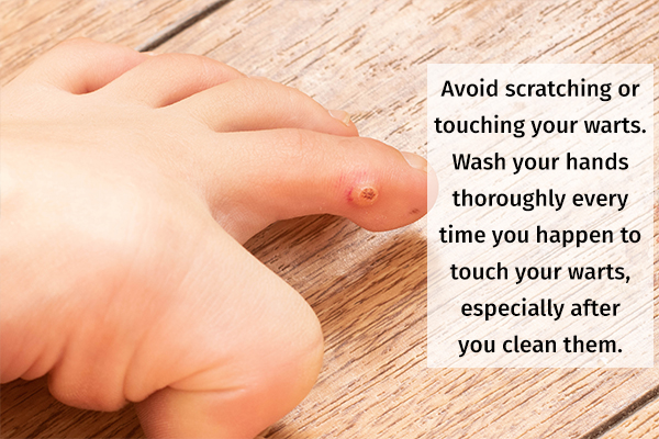 self-care measures to aid recovery from warts