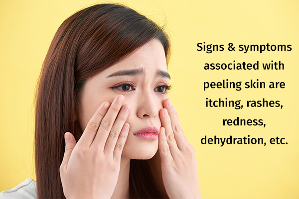 Peeling Skin Causes Symptoms And Medical Treatment