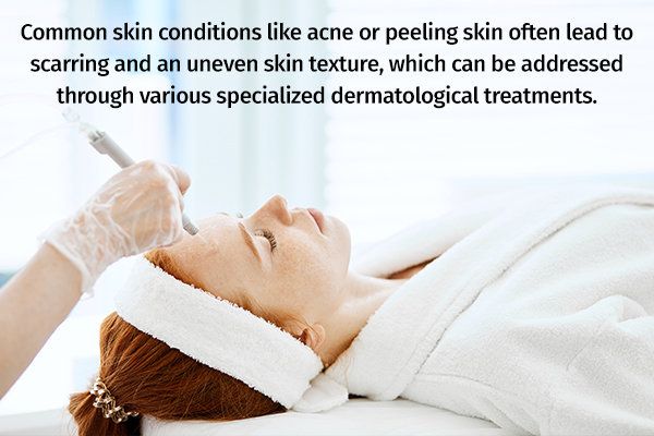 medical procedures to obtain smooth, clear skin