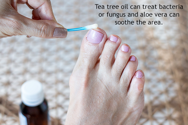 treatment for foot rashes
