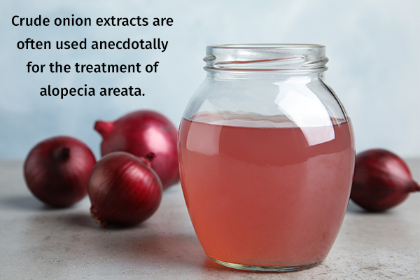 onion juice can help treat alopecia areata
