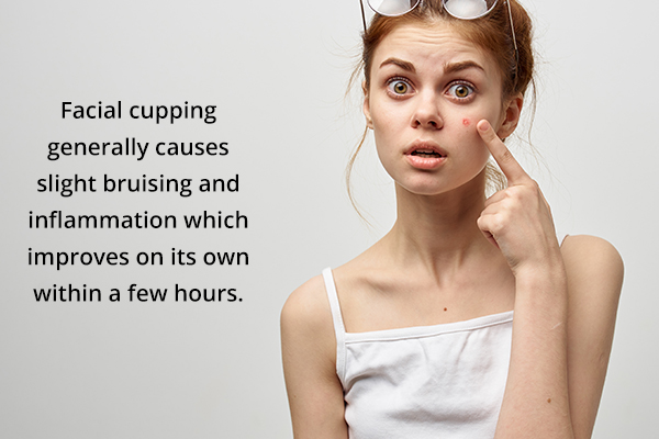facial cupping side effects