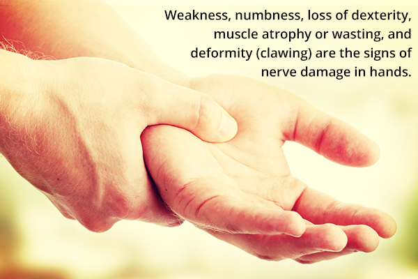 signs and symptoms of nerve damage in the hands