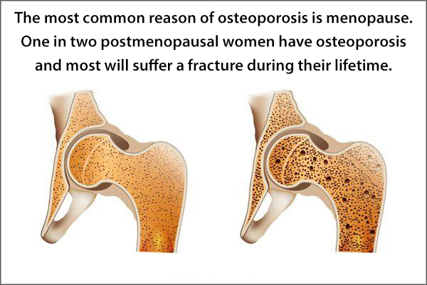 menopause can be a common reason for osteoporosis
