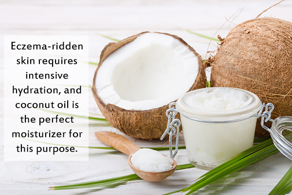 coconut oil can help reduce dryness caused by eczema