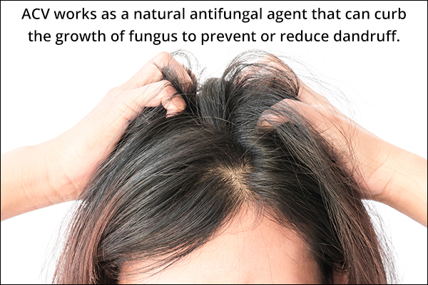 acv can help curb scalp infections