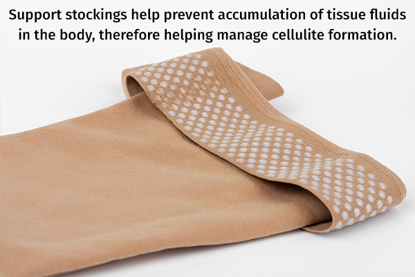 wear support stockings to help manage cellulite formation
