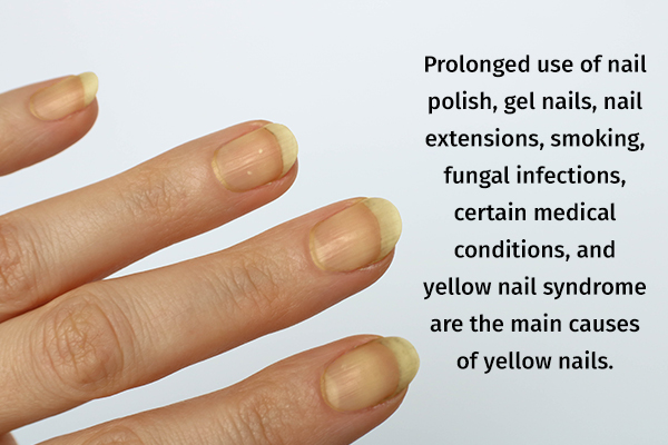 causes behind yellow nails