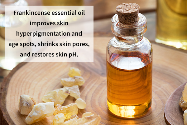 frankincense essential oil improves skin hyperpigmentation and age spots