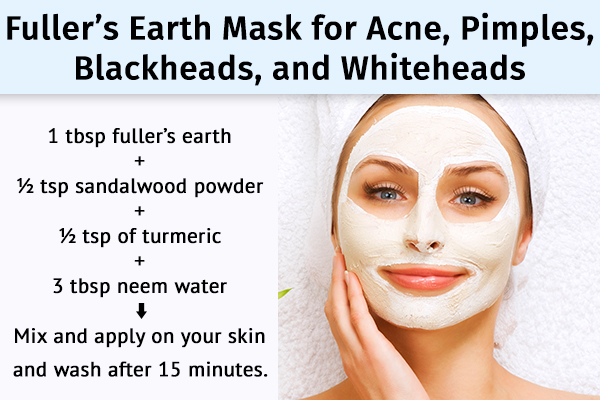 fuller's earth can help manage acne, pimples, and blackheads