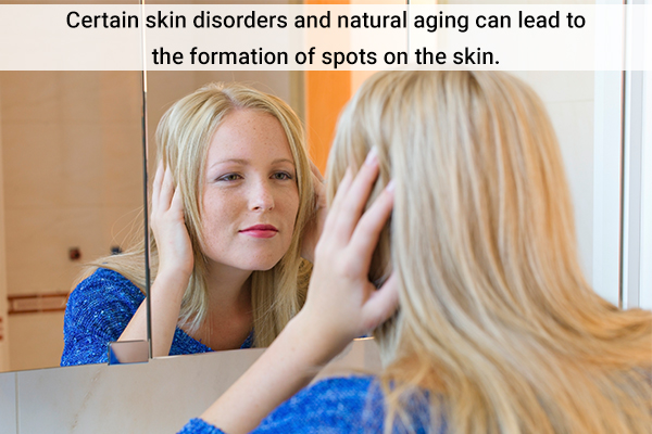 argan oil application can help reduce hyperpigmentation