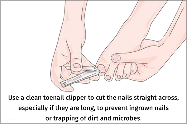 trim your nails to prevent nail infections