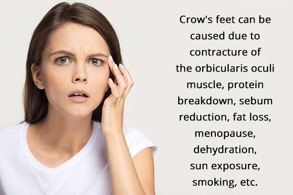 what causes crow's feet?