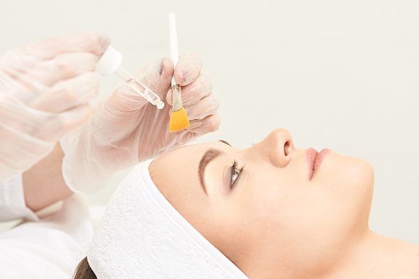 chemical peels can help exfoliate clogged pores