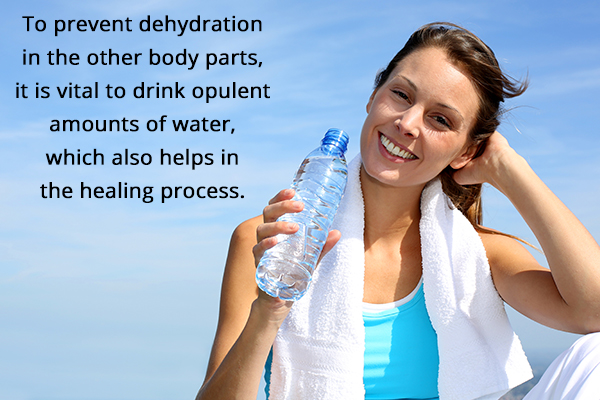 drinking water regularly helps in proper healing of sunburnt areas