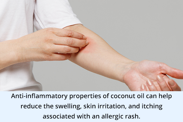 coconut oil can help soothe allergic rashes