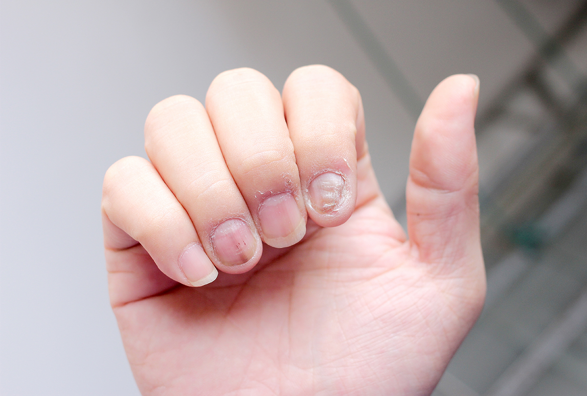 tips to prevent nail infections
