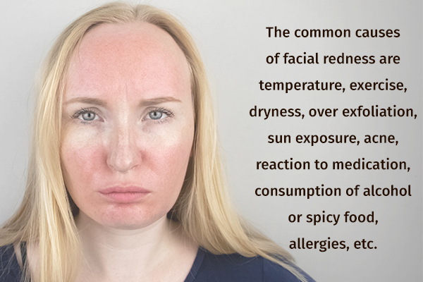 common causes behind facial redness