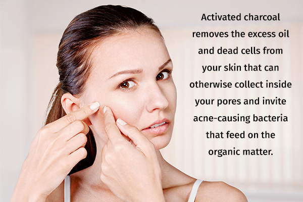 activated charcoal usage can help clear acne