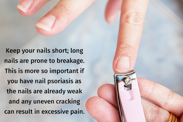 measures that can help prevent nail psoriasis