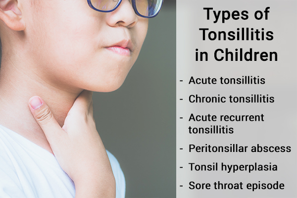 types of tonsillitis in children