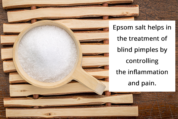 Epsom salt can help control and prevent blind pimples