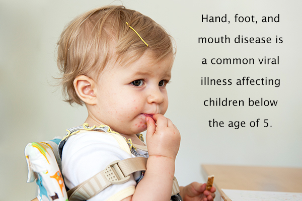 hand, foot, and mouth disease is a common viral infection in kids