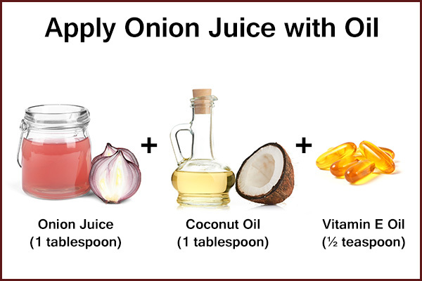 try using onion juice by mixing it with hair oils