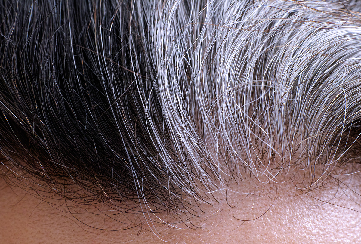 onion juice to help manage gray hair