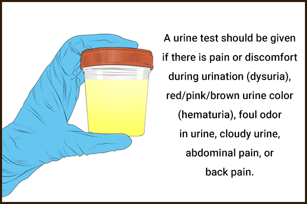 when is a urine test recommended?