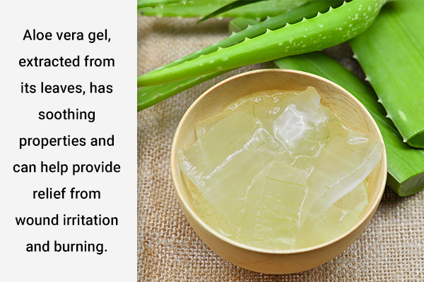 applying aloe vera gel can help soothe minor wounds