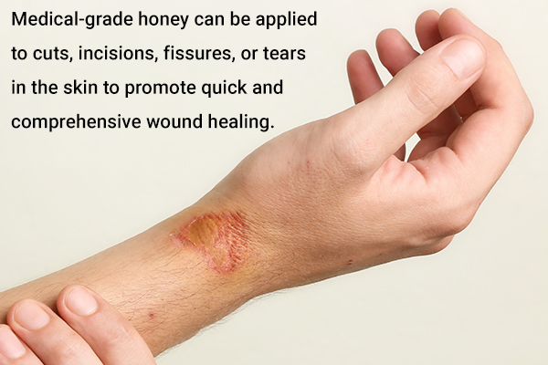honey to help treat cuts and wounds