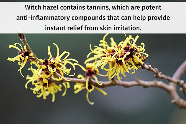 witch hazel usage can provide relief from hives