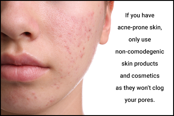additional tips for acne control and management