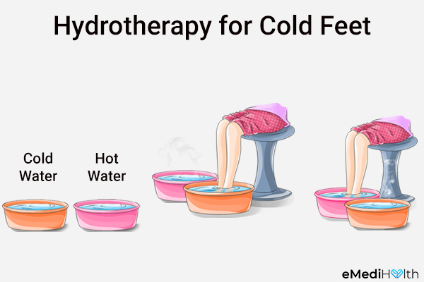hydrotherapy can be used to help manage cold feet