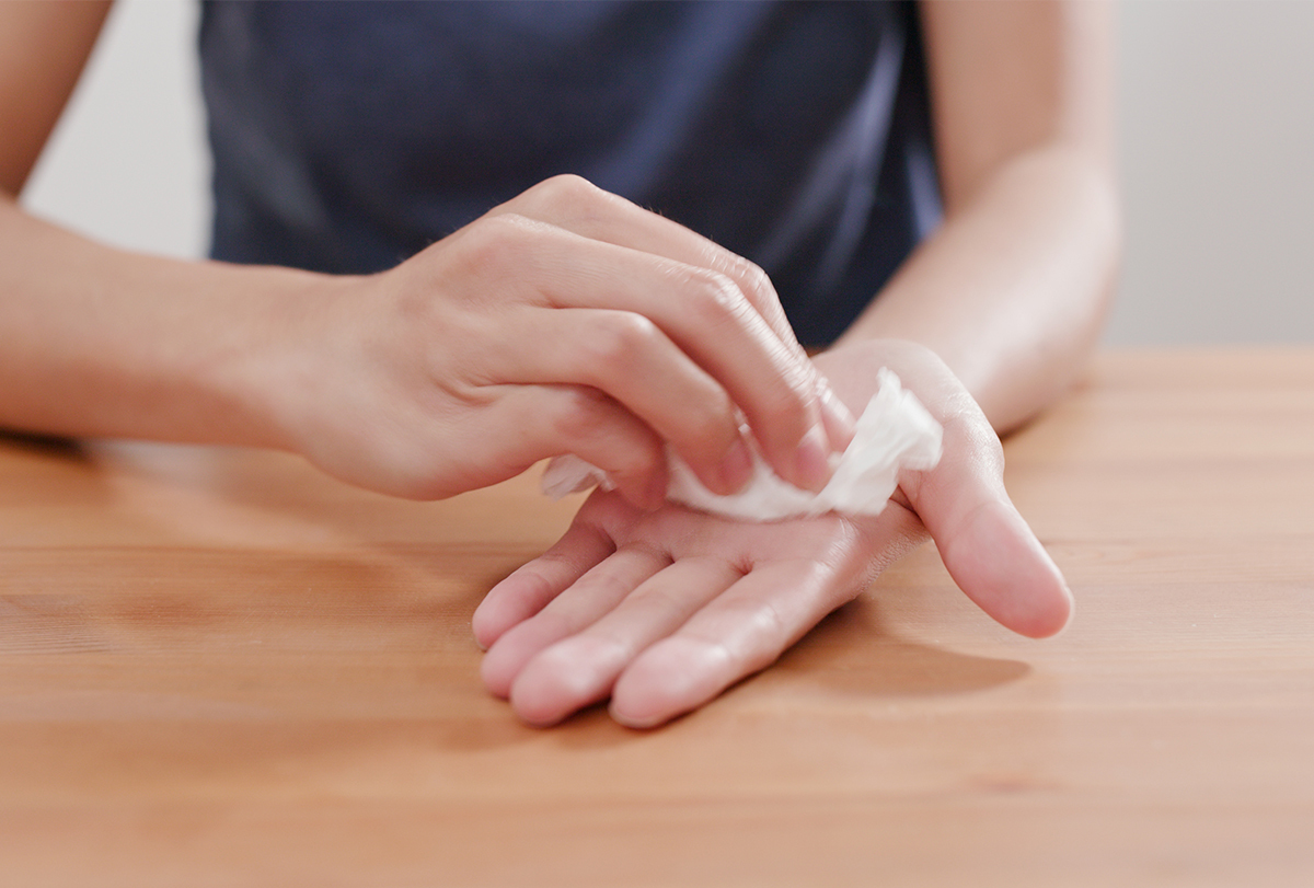 sweaty palms and feet: causes and treatments