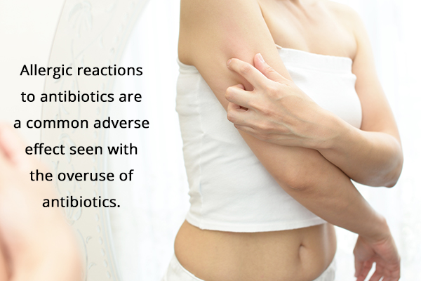 allergic reactions to antibiotics are a common occurence