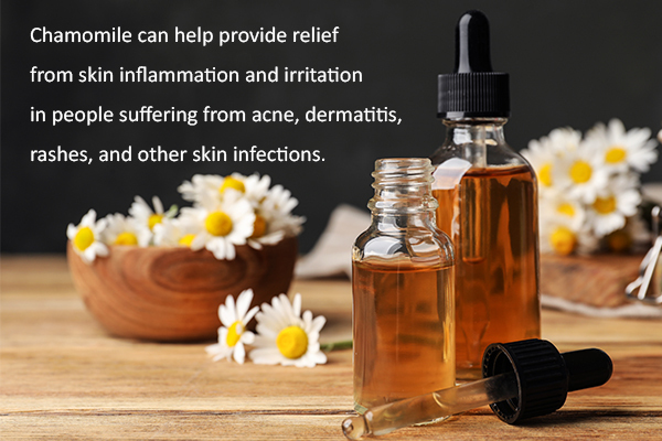 chamomile essential oil usage can help improve dry skin 