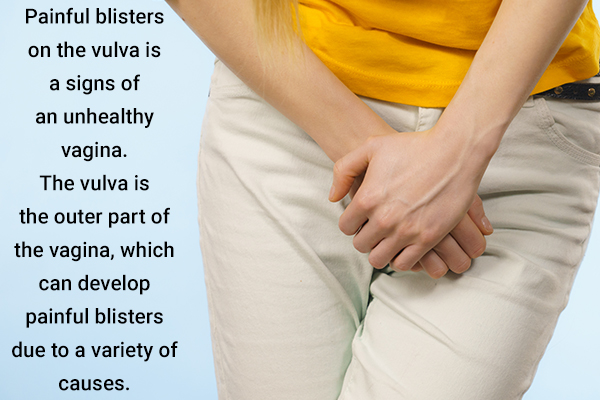 painful blisters on the vulva can be sign of an unhealthy vagina