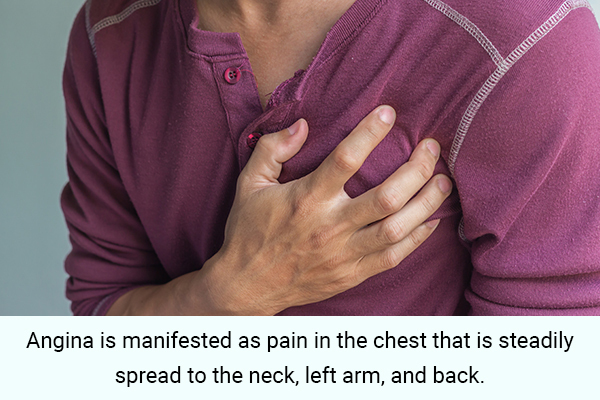 angina as a symptom of arm pain