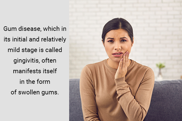 causes behind gum swelling