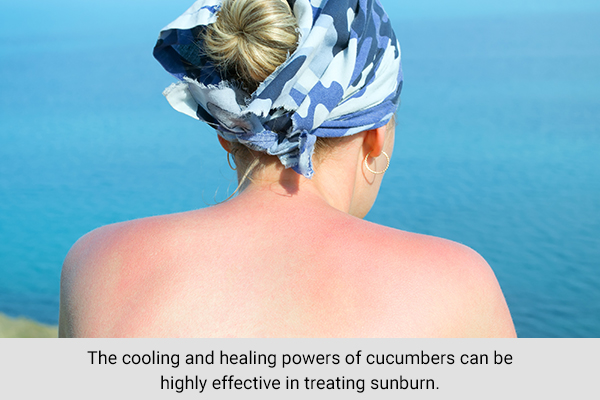 the cooling properties of cucumber can help heal a sunburn