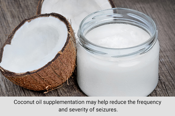 coconut oil usage can help reduce frequency and severity of seizures