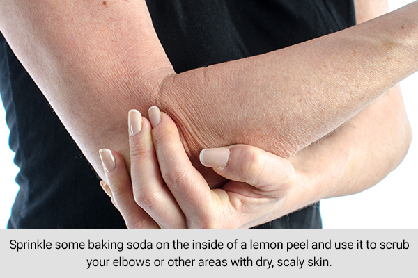 using lemon peels with baking soda can scrub your dry, scaly skin
