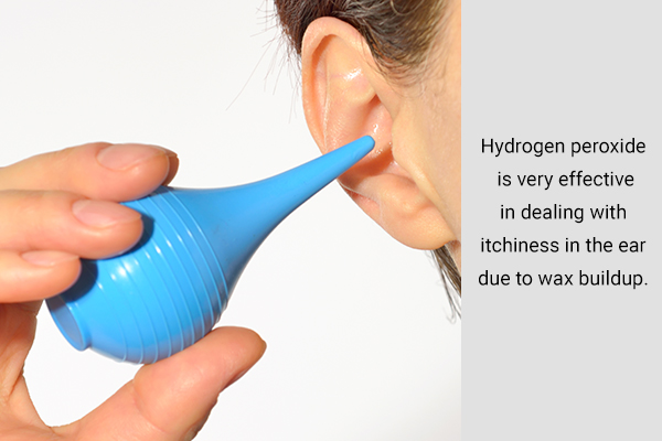 hydrogen peroxide is effective in dealing with ear itchiness
