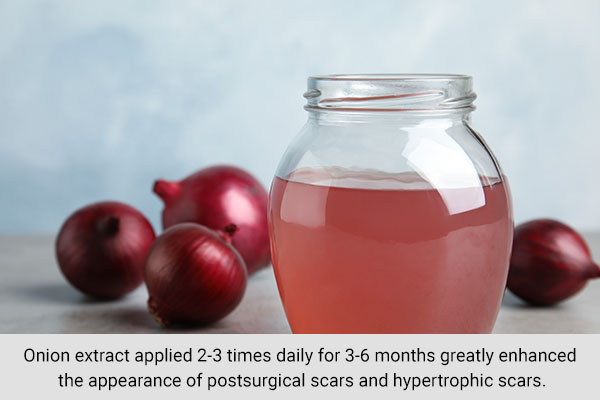 using onion extract gels can help improve scar appearance